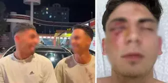 They blinded him by beating him with clubs and recorded a video with blood on their hands! The suspects, who were released in 1.5 months, are in custody again.
