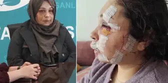 The personnel of the Presidential Protection Department who caused his wife to be in this condition has been arrested.