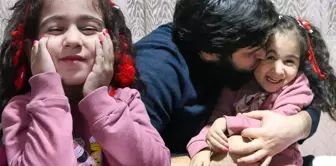 Elif, who was born with webbed fingers, had her treatment interrupted by her father's job loss.