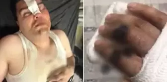 They shared the bill, but he took the beating alone! Everything started with a 13 thousand 