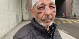 They wanted to light it, and then it ended up like this.