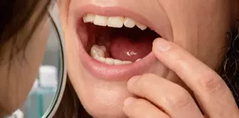 When she woke up in the morning, she had no teeth! The real condition that surprised even the doctors emerged in the hospital.