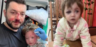 Here is the requested punishment for those who hospitalized 14-month-old baby Ikra! The scooter was classified as a weapon.