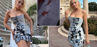 Chilling claim in the death of Ayşegül Eraslan! Her friend shared the autopsy report.