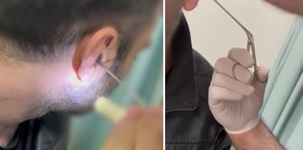 He was caught with drugs hidden in his ear.