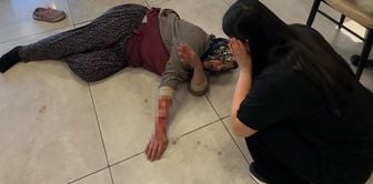 The aggressive dog tore off the woman's arm