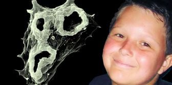 He took the life of an 11-year-old child! It enters the body through the nostrils, and cases are increasing worldwide.