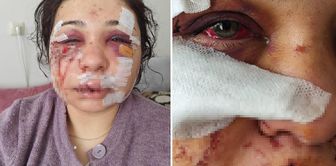 Shock imprisonment for woman beaten nearly to death by her police officer husband