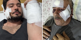 The lawyer of the party alleged to have used brass knuckles in Izmit said that they did not use brass knuckles.