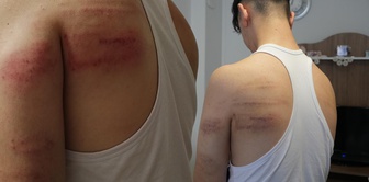 Unbelievable torture of a 15-year-old barber apprentice! They beat him with an iron rod and locked him in the toilet.