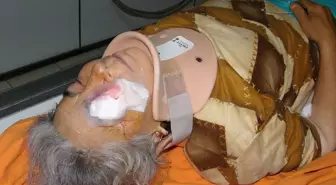 Ağaçtan Düşen Kadın Ağır Yaralandı