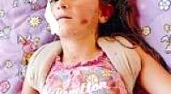 12 Saat Boyunca Uçurumun Dibinde Cesetlerle Kaldı