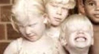 Ender Görülen Albino Olayı