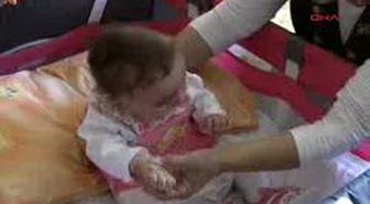 Tekirdağ - Doğum Sırasında Sinirleri Zedelenen Bebek Felç Oldu