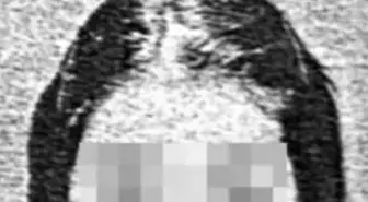 Bir 'Fatmagül' Olayı da Adana'dan