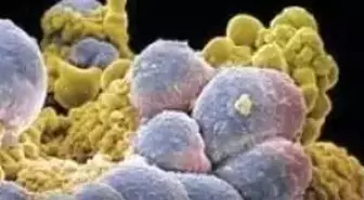 Kanseri Hapla Yenen Türk Bilim Adamı, DHA'ya Konuştu