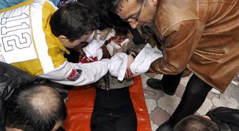 Eski Eşini Falçatayla Yaralayan Polise Teslim Oldu