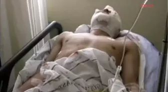 Mersin Tinerle Soba Yakmaya Çalışanca Öğretmen ve 3 Öğrenci Yaralandı