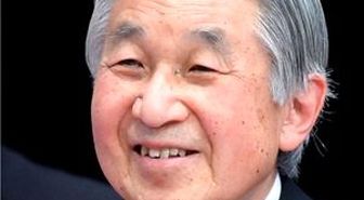 Japon İmparatoru Baypas Olacak