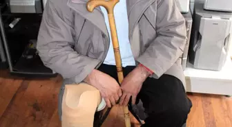 Bacak Protezinin Değiştirilmesini İstiyor