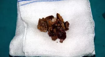 Çarşamba'da İlk Ameliyat