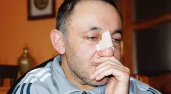 Burnu ve Parmağı Kırılan Doktor, İki Ayrı Ameliyat Geçirdi