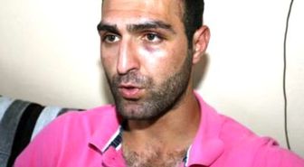 Polis Tarafından Darp Edildiğini İddia Etti