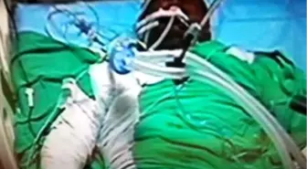 Cezaevinde Yanarak Yaralandı (2)