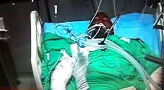 Cezaevinde Yanarak Yaralanan Mahkum, Öldü