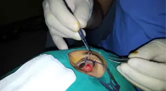 Emekli Öğretmenin Gözünden Parazit Çıktı