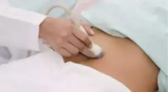 'Çikolata Kisti' Kısırlık Nedeni mi?