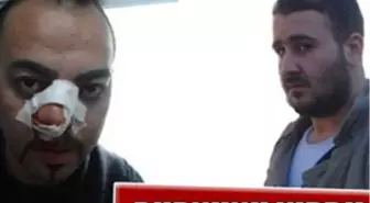 Şaka Yapmak İsterken Dayak Yedi