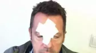 Kavga Nedeni: Açık Fermuar