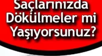 Saç Ekimi Hakkında Tüm Gerçekler

