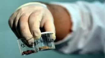 Mta Yılda 3 Bin Böbrek Taşı İnceliyor