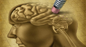 Alzheimer Önlenemez Ama Yıllarca Ötelenebilir