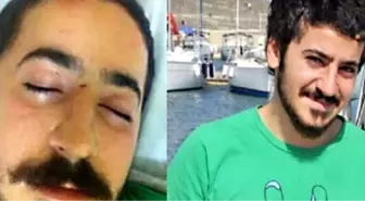 Biber Gazından Kaçtı Hayatı Karardı