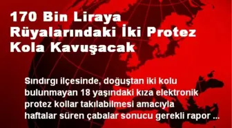 170 Bin Liraya Rüyalarındaki İki Protez Kola Kavuşacak