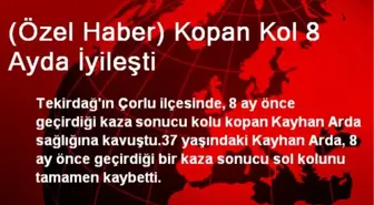 (Özel Haber) Kopan Kol 8 Ayda İyileşti