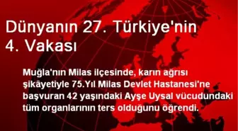 Dünyanın 27. Türkiye'nin 4. Vakası