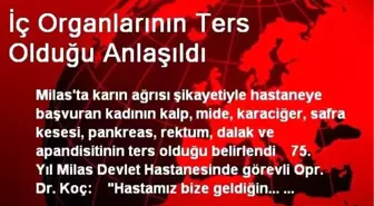 İç Organlarının Ters Olduğu Anlaşıldı