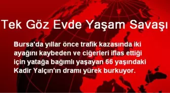 Tek Göz Evde Yaşam Savaşı