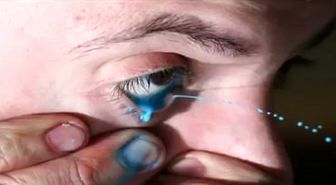 Arjantinli Ressam, Gözünden Fışkıttığı Boyayla Resim Yaptı