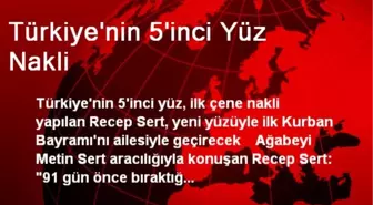 Türkiye'nin 5'inci Yüz Nakli