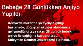 Bebeğe 28 Günlükken Anjiyo Yapıldı