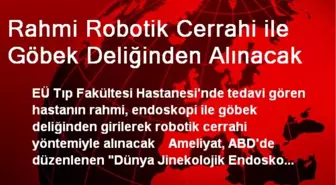 Rahmi Robotik Cerrahi ile Göbek Deliğinden Alınacak