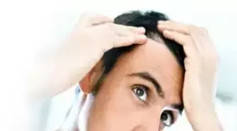 Saç Ekimine Teknolojinin Son Armağanı: 'Micro Fue Saç Ekimi'