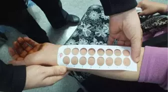 Alerji Deyip Geçmeyin