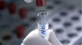 Hastaların Çoğu, HIV'li Olduğunu Bilmiyor