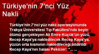 Türkiye'nin 7. Yüz Nakli Yapılacak